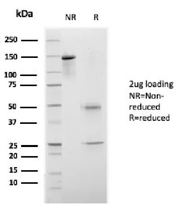 Anti-CELA3B / ELA3B (Pancreatic Function Marker) Monoclonal Antibody(Clone: rCELA3B/1811)