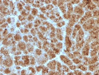 Anti-CELA3B / ELA3B (Pancreatic Function Marker) Monoclonal Antibody(Clone: CELA3B/1257)