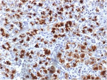 Anti-CELA3B / ELA3B (Pancreatic Function Marker) Monoclonal Antibody(Clone: CELA3B/1757)