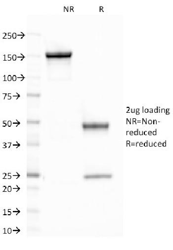 Anti-CELA3B / ELA3B (Pancreatic Function Marker) Monoclonal Antibody(Clone: CELA3B/1758)