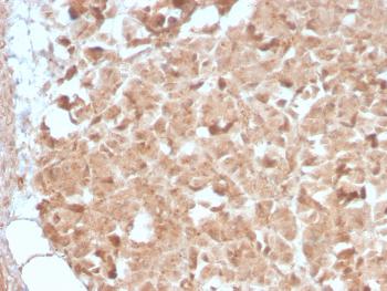 Anti-CELA3B / ELA3B (Pancreatic Function Marker) Monoclonal Antibody(Clone: CELA3B/2809R)