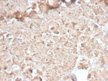 Anti-CELA3B / ELA3B (Pancreatic Function Marker) Monoclonal Antibody(Clone: CELA3B/2810R)