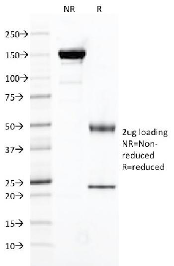 Anti-FOLH1 / PSMA (Prostate Epithelial Marker) Monoclonal Antibody(Clone: FOLH1/2121)