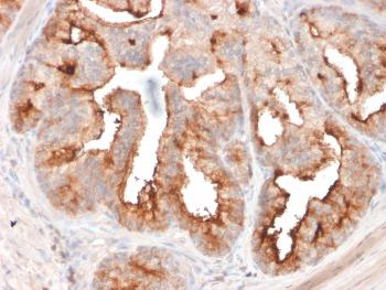 Anti-FOLH1 / PSMA (Prostate Epithelial Marker) Monoclonal Antibody(Clone: FOLH1/2354)