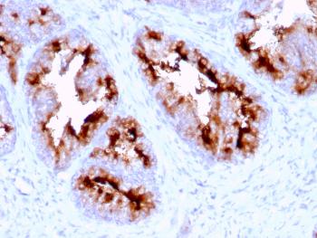 Anti-FOLH1 / PSMA (Prostate Epithelial Marker) Monoclonal Antibody(Clone: FOLH1/2363)