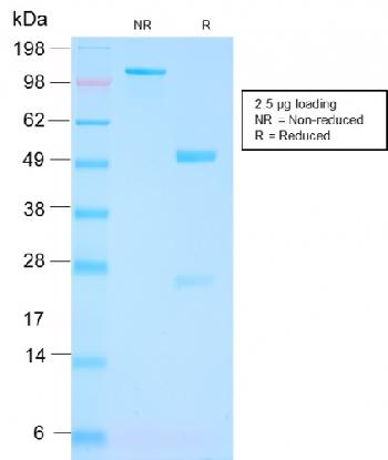 Anti-FOLH1 / PSMA (Prostate Epithelial Marker) Monoclonal Antibody(Clone: FOLH1/3149R)