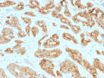 Anti-AMACR / p504S (Prostate Cancer Marker) Monoclonal Antibody(Clone: AMACR/1723)