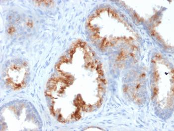 Anti-AMACR / p504S (Prostate Cancer Marker) Monoclonal Antibody(Clone: AMACR/1864)