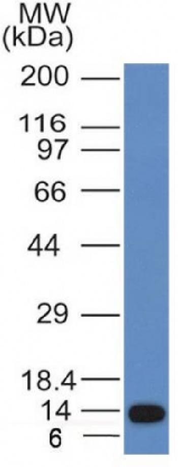 Anti-ALK (Anaplastic Lymphoma Kinase) / CD246 Monoclonal Antibody(Clone: ALK/1031)