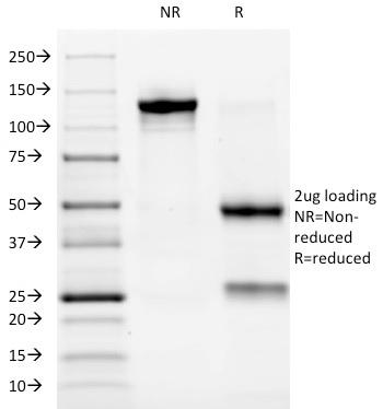 Anti-ALK (Anaplastic Lymphoma Kinase) / CD246 Monoclonal Antibody(Clone: ALK/1032)