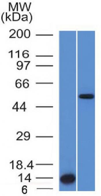 Anti-ALK (Anaplastic Lymphoma Kinase) / CD246 Monoclonal Antibody(Clone: ALK/1503)