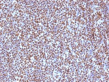 Anti-ALK (Anaplastic Lymphoma Kinase) / CD246 Monoclonal Antibody(Clone: ALK/1504)