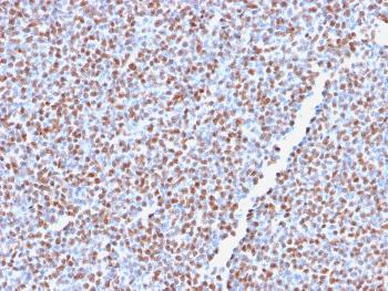 Anti-ALK (Anaplastic Lymphoma Kinase) / CD246 Monoclonal Antibody(Clone: ALK1/2766R)