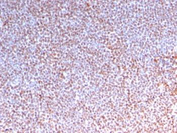 Anti-ALK (Anaplastic Lymphoma Kinase) / CD246 Monoclonal Antibody(Clone: ALK/3218R)