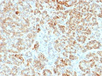 Anti-Frataxin (Marker of Friedreich Ataxia) Monoclonal Antibody(Clone: FXN/2124)