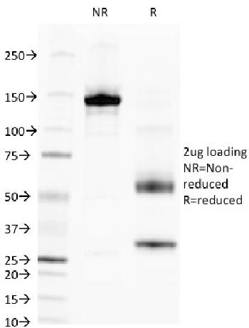 Anti-Alkaline Phosphatase (Tissue-Nonspecific) Monoclonal Antibody(Clone: V17.1)