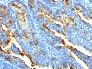 Anti-FSH-Receptor (Ovarian Marker) Monoclonal Antibody(Clone: FSHR/1400)