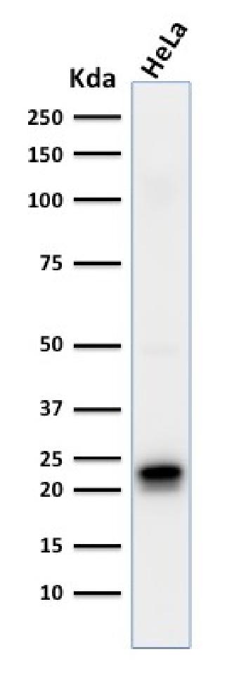 Anti-Ferritin, Heavy Chain (FTH) (Microglia Marker) Monoclonal Antibody(Clone: FTH/2081)