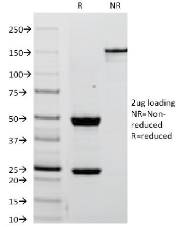 Anti-Alkaline Phosphatase (Placental) / PLAP (Germ Cell Tumor Marker) Monoclonal Antibody(Clone: ALPP/238)