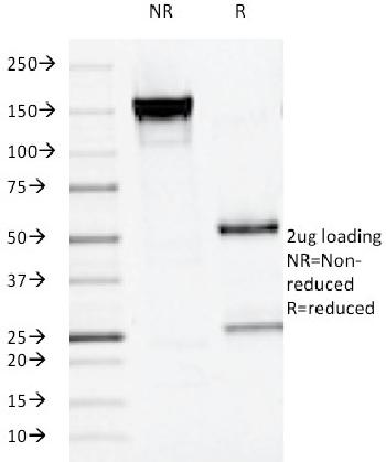 Anti-Alkaline Phosphatase (Placental) / PLAP (Germ Cell Tumor Marker) Monoclonal Antibody(Clone: ALPP/516)