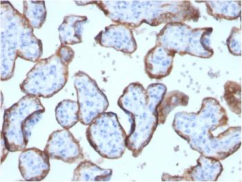 Anti-Alkaline Phosphatase (Placental) / PLAP (Germ Cell Tumor Marker) Monoclonal Antibody(Clone: ALPP/2899R)