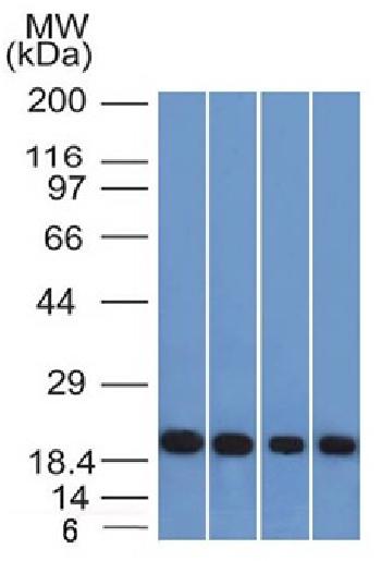 Anti-Ferritin, Light Chain (Node-Negative Breast Tumor Prognostic Marker) Monoclonal Antibody(Clone: FTL/1386)