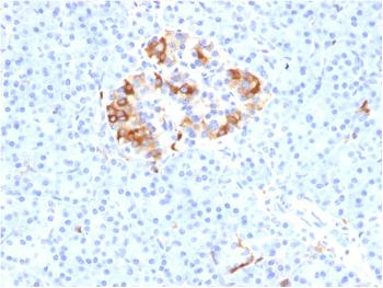 Anti-Ferritin, Light Chain (Node-Negative Breast Tumor Prognostic Marker) Monoclonal Antibody(Clone: FTL/1387)