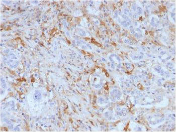 Anti-Ferritin, Light Chain (Node-Negative Breast Tumor Prognostic Marker) Monoclonal Antibody(Clone: FTL/1388)