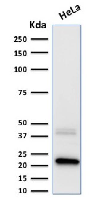 Anti-Ferritin, Light Chain (Node-Negative Breast Tumor Prognostic Marker) Monoclonal Antibody(Clone: FTL/1389)