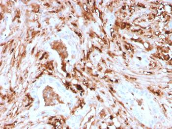 Anti-Ferritin, Light Chain (Node-Negative Breast Tumor Prognostic Marker) Monoclonal Antibody(Clone: rFTL/1388)