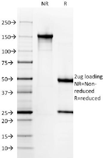 Anti-Gastrin Monoclonal Antibody(Clone: GAST/2631)