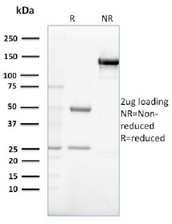 Anti-Gastrin Monoclonal Antibody(Clone: GAST/2632)