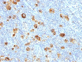 Anti-CD15 / FUT4 (Reed-Sternberg Cell Marker) Monoclonal Antibody(Clone: FUT4/1478R)