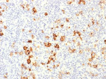 Anti-CD15 / FUT4 (Reed-Sternberg Cell Marker) Polyclonal Antibody