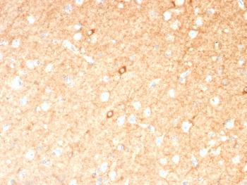 Anti-GAD1 / GAD67 (GABAergic Neuronal Marker) Monoclonal Antibody(Clone: GAD1/2391)