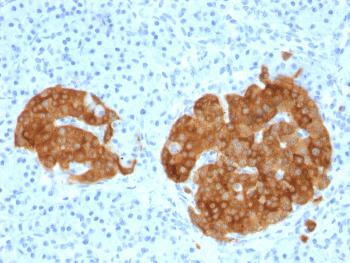 Anti-GAD2 / GAD65 (GABAergic Neuronal Marker) Monoclonal Antibody(Clone: GAD2/1960)