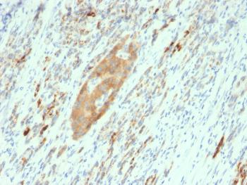 Anti-GAD2 / GAD65 (GABAergic Neuronal Marker) Monoclonal Antibody(Clone: GAD2/2362)