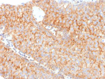 Anti-PAI-RBP1 / SERBP1 / SERPINE1 Monoclonal Antibody(Clone: SERBP1/3491)