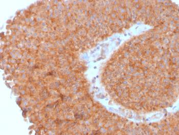 Anti-PAI-RBP1 / SERBP1 / SERPINE1 Monoclonal Antibody(Clone: SERBP1/3495)