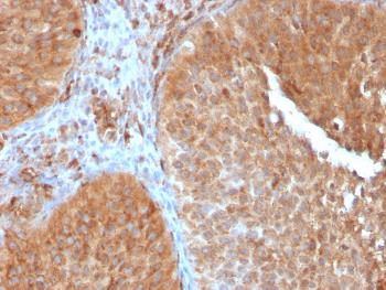 Anti-PAI-RBP1 / SERBP1 / SERPINE1 Monoclonal Antibody(Clone: SERBP1/3497)