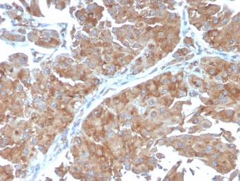 Anti-PAI-RBP1 / SERBP1 / SERPINE1 Monoclonal Antibody(Clone: SERBP1/3498)