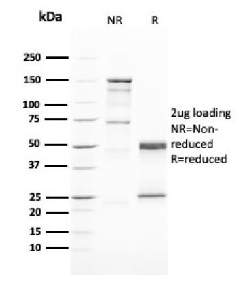 Anti-GATA-3 (Breast and Urothelial Marker) Monoclonal Antibody(Clone: GATA3/2446)