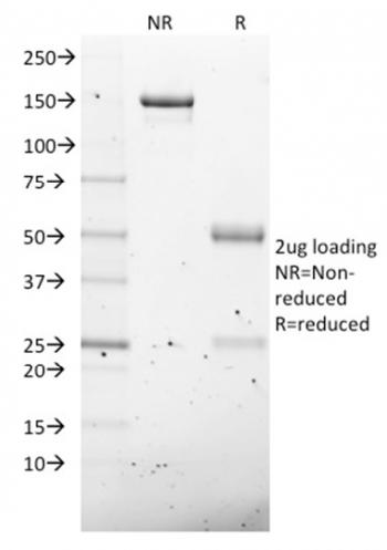 Anti-NKX2.8 Monoclonal Antibody(Clone: NKX28/2547)