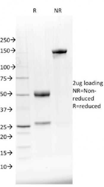 Anti-NKX2.8 Monoclonal Antibody(Clone: NKX28/2548)