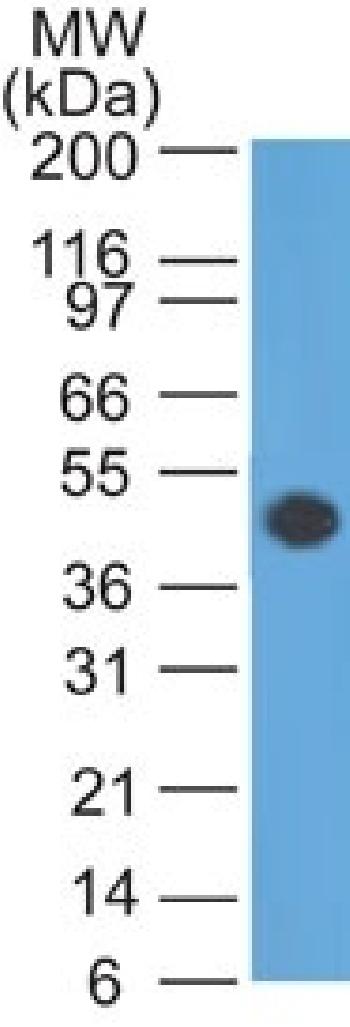 Anti-GFAP (Astrocyte & Neural Stem Cell Marker) Monoclonal Antibody(Clone: GA-5)