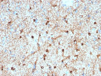 Anti-GFAP (Astrocyte & Neural Stem Cell Marker) Monoclonal Antibody(Clone: GFAP/2076)