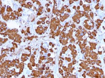 Anti-Growth Hormone (Pituitary Marker) Monoclonal Antibody(Clone: GH/1371)