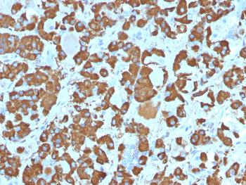 Anti-Growth Hormone (Pituitary Marker) Monoclonal Antibody(Clone: SPM106)