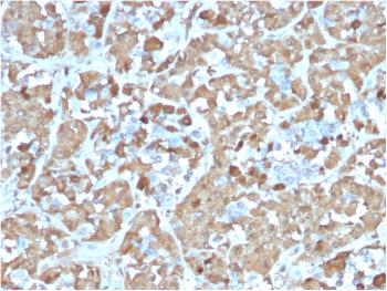 Anti-Growth Hormone (Pituitary Marker) Monoclonal Antibody(Clone: rGH/1450)