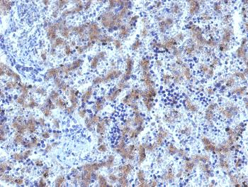 Anti-Glypican-3 (GPC3) (Hepatocellular Carcinoma Marker) Monoclonal Antibody(Clone: GPC3/1534R)